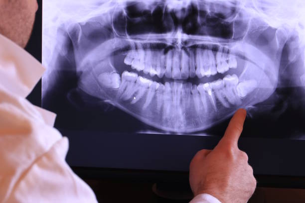 Best Emergency Treatment for Toothache in Mountain Lake, MN